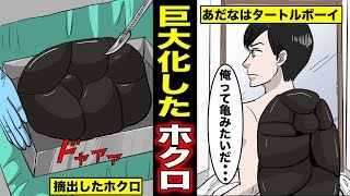 漫画 背中に亀の甲羅のような巨大なホクロを持つ タートルボーイ と呼ばれた男の壮絶人生 マンガ動画 Youtube 漫画 背中に亀の甲羅のような巨大なホクロを持つ タートルボーイ と呼ばれた男の壮絶人生 マンガ動画 Youtube