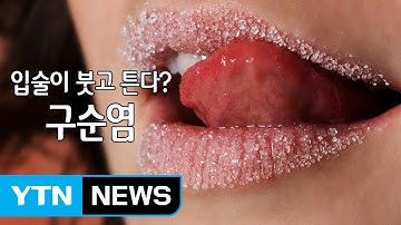 환절기, 입술이 트고 갈라진다? / YTN (Yes! Top News)