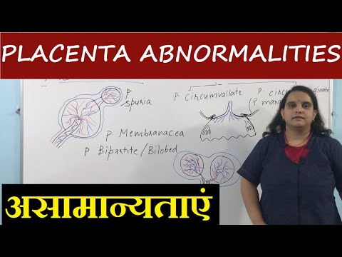 Placental Abnormalities in Hindi | Morphological variation of Placenta | Nursing lecture