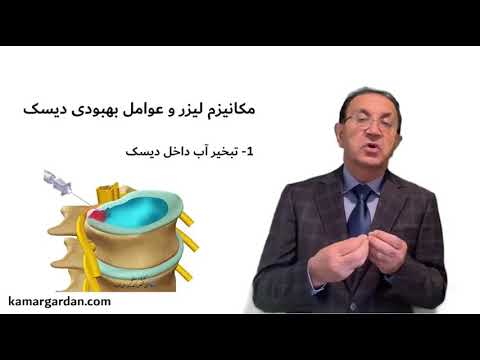 تصویری: چگونه و چرا دیسک های وینیل ساخته می شوند؟