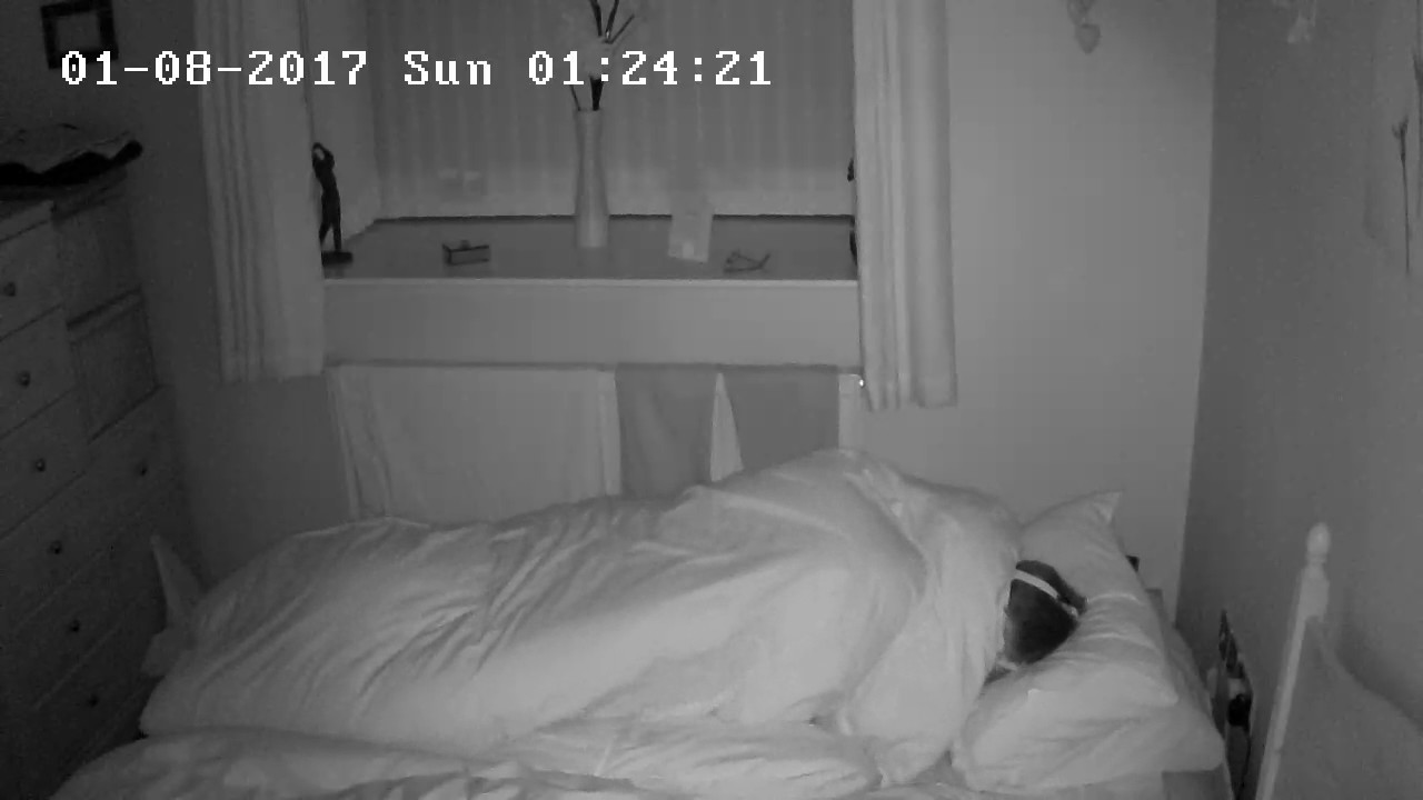 REM SLEEP BEHAVIOUR DISORDER 7 YouTube