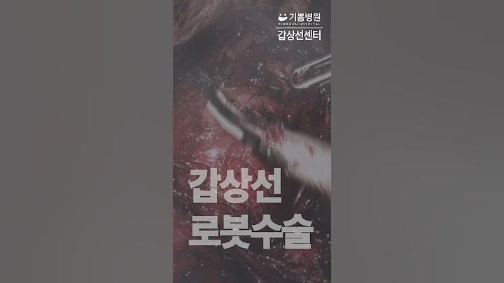갑상선암 다빈치 로봇수술 #shorts