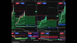 SPX 0DTE #0390 +~$180,000 9/03/2026