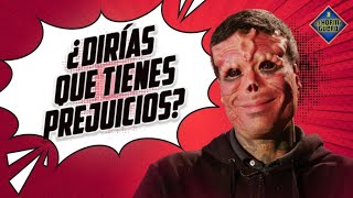 Tenemos Prejuicios Ante Un Físico Diferente? Lo Comprobamos El Hormiguero