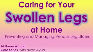 Swollen Legs? :Caring for them at Home screenshot 5
