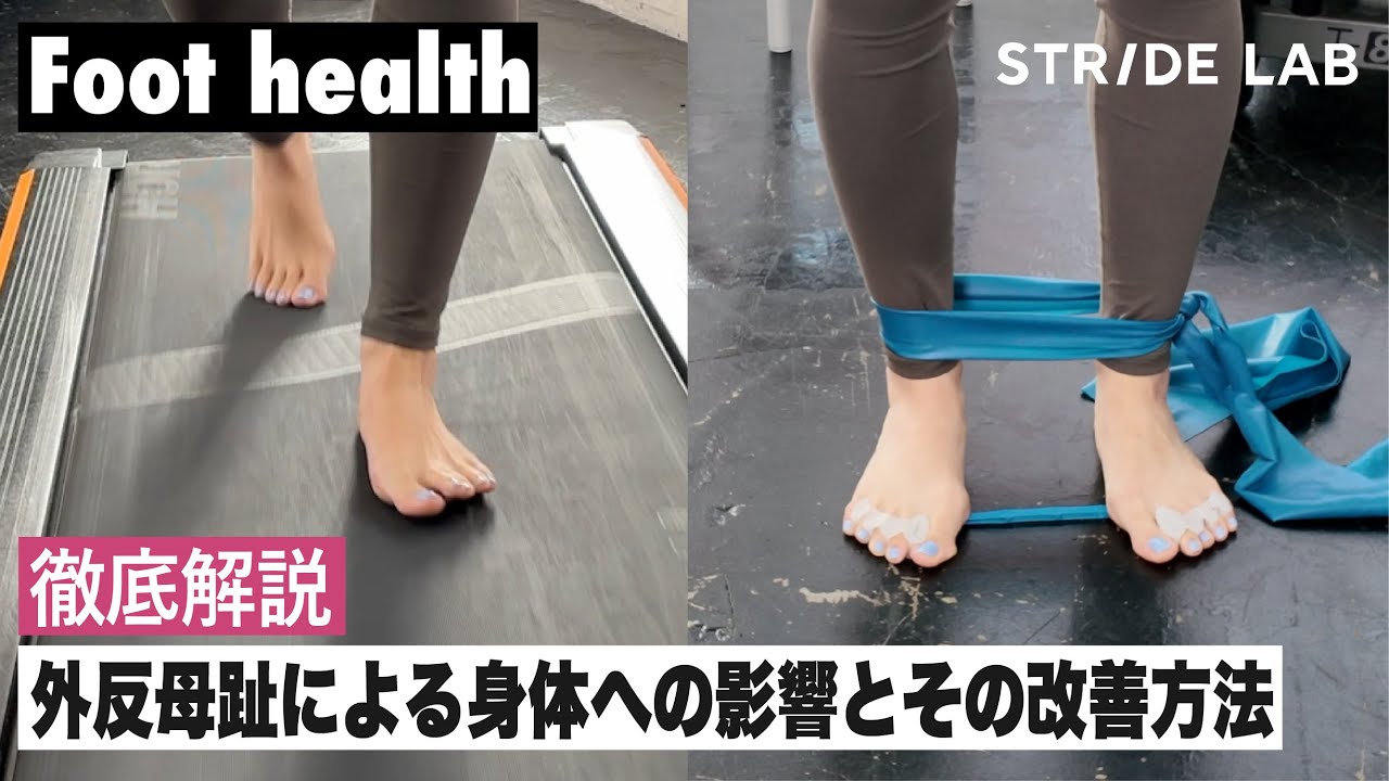【Foot health】外反母趾による身体への影響とその改善方法