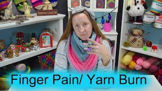 How I deal with yarn burn and finger pain