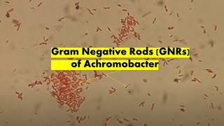Gram Negative rods of Achromobacter