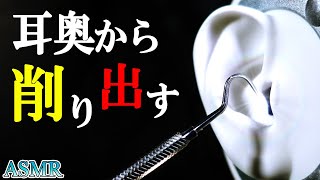 [耳かきASMR]スケーラーで鼓膜に張り付いた乾燥耳垢をバリバリ引っ掻いて削り取る痛いけどなぜか眠くなるゾワゾワ歯科器具耳掃除音（両耳同時）【音好き】/Intense Ear Cleaning