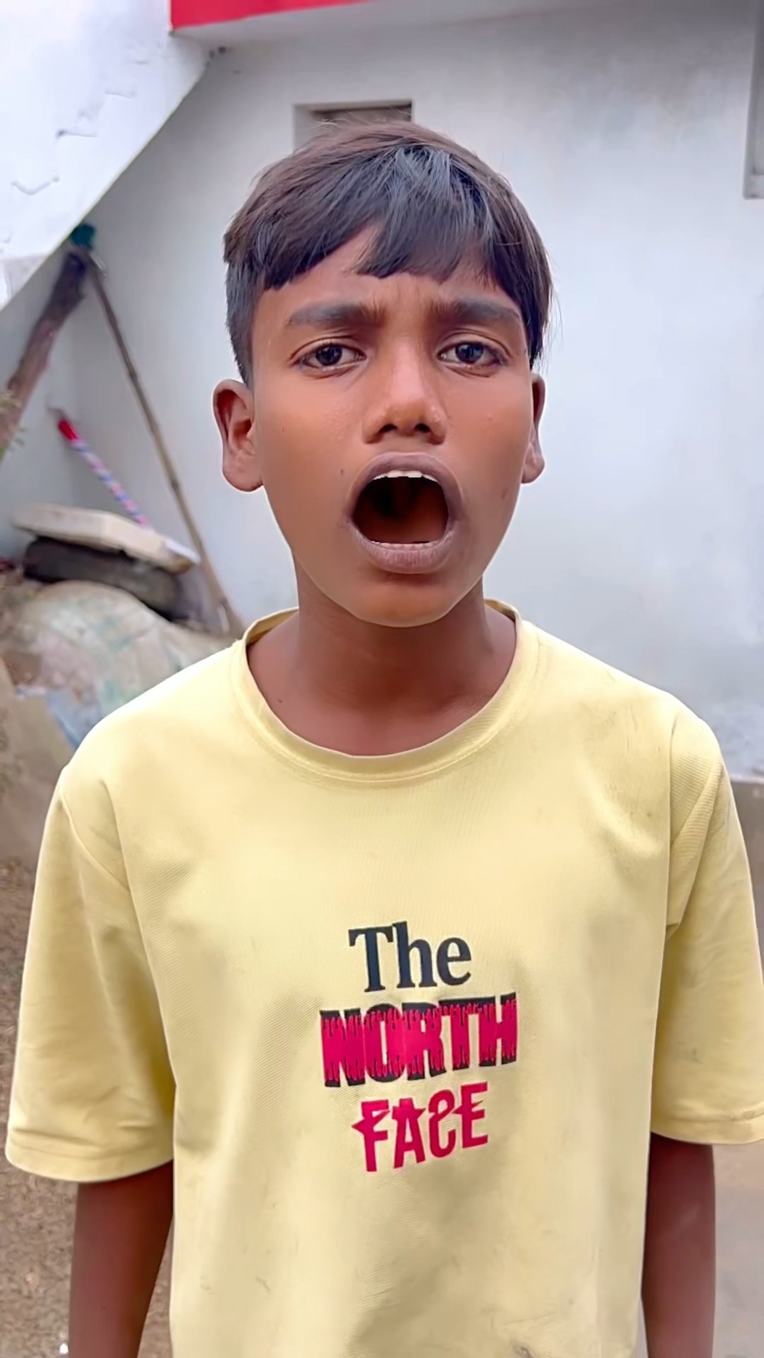 CHOTU KA FOOTBALL TEETH #shorts @FACTFIREKING