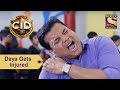 Your Favorite Character | Daya Gets Injured | CID