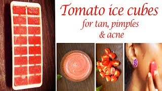 Tomato Ice Cubes to remove tan, oil, pimples & dark spots | Fresh & Oil control