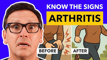 Arthritis Explained: Symptoms, Causes, and Treatment Options