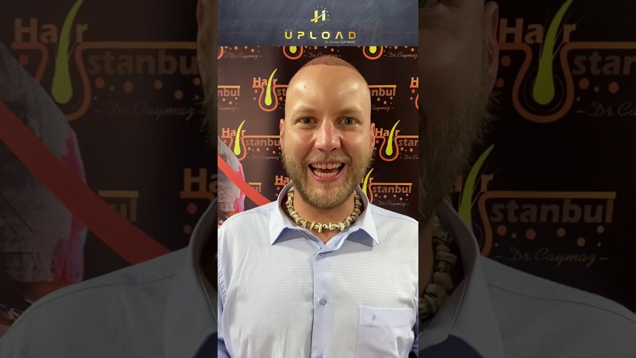 Mr.Zillgitt from USA/Denver - 4700 Graft | Hair Transplant 2021