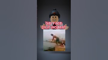 The Story Behind The Face Split Incident #shorts