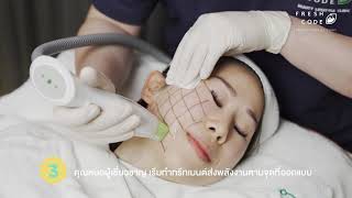 Painless Therma ยกกระชับผิวหน้า ยกหน้าใหม่ไม่ต้องผ่าตัด! รีวิว thermage