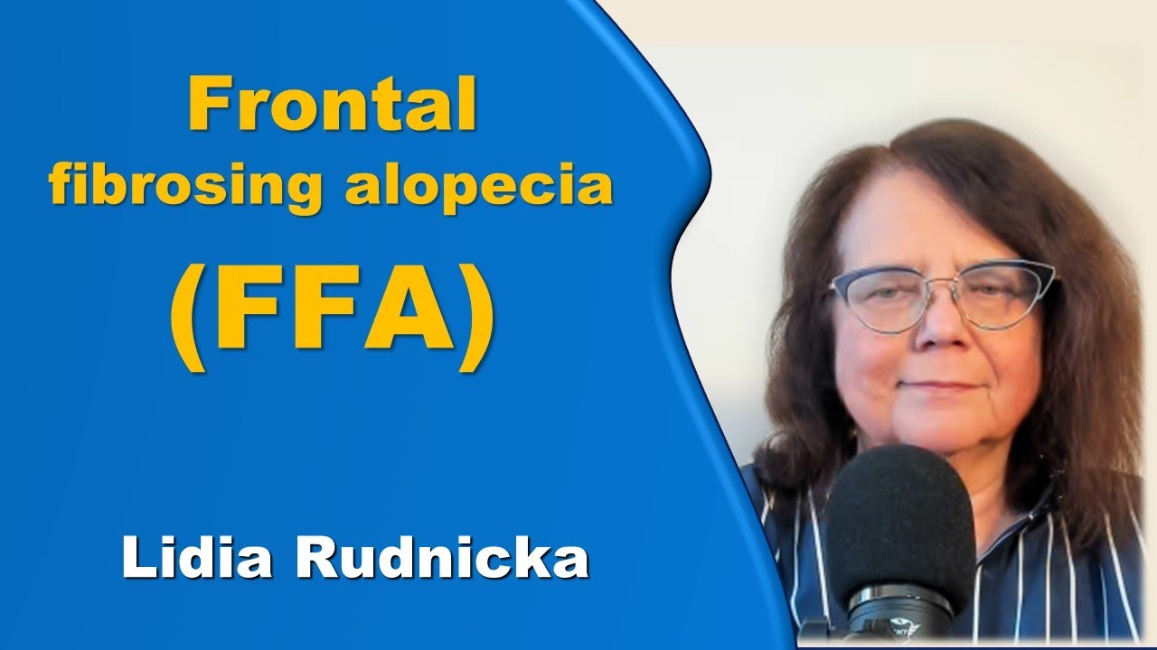 Frontal Fibrosing Alopecia