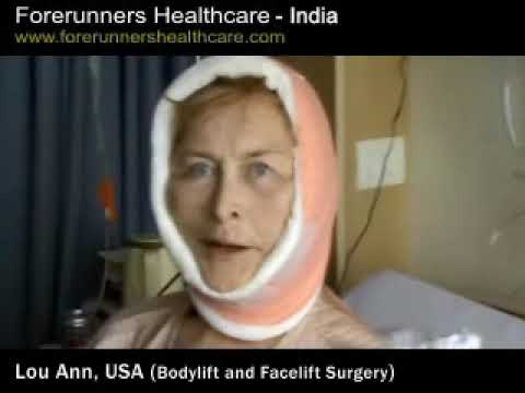 Lou Anne's Body Lift and Face Lift's Success Story