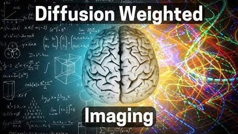 DWI MRI Scan Sounds Explained (Diffusion Weighted Imaging for Multiple Sclerosis) MS MRI Scan