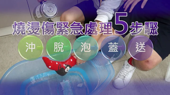 烧烫伤紧急处理步骤 - 天天要闻