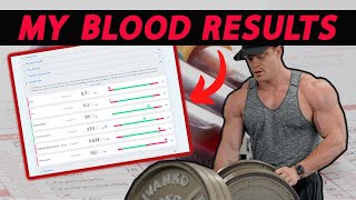 My FULL Bloodwork AFTER Using Steroids | Pro Bodybuilder