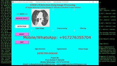 Corona Detection Using CNN Convolutional Neural Network |With Source Code | Python OpenCV Project