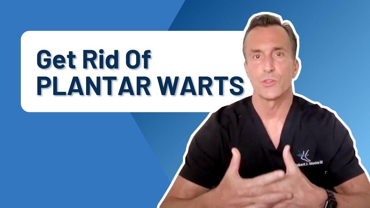 Plantar Warts What Is The Quickest Way To Get Rid Of Them?? YouTube