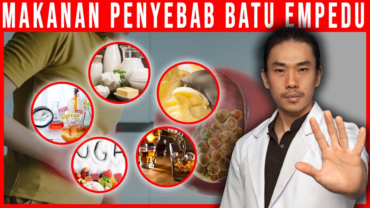 Ini Makanan Penyebab Batu Empedu
