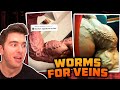 Meathead With Worms For Veins - Healthy Or Not?