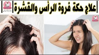 وصفة فعالة للتخلص من حكة فروة الرأس مع علاج  القشرة في الشعر | لالة مولاتي - Lala Moulati