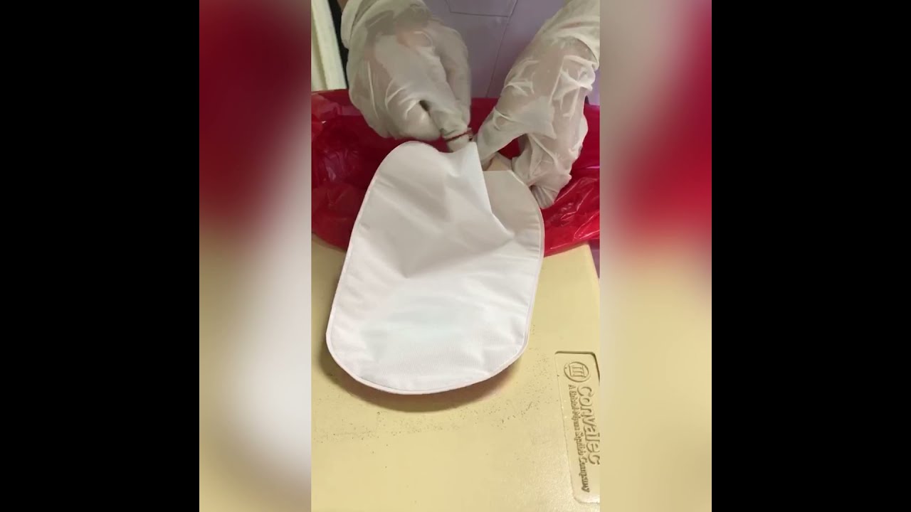 สื่อการสอน Colostomy care (การเปลี่ยนถุงรองรับอุจจาระทางทวารเทียม)