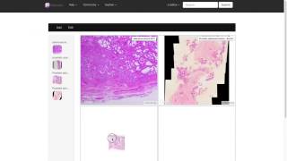 Pathobin Pathology Case Presentation Tool And Windows Viewer