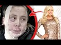 Plastic Surgery That Made Stars Unrecognizable