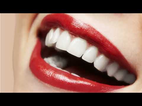 Teeth Whitening : Advanced Dentistry of Coral Springs