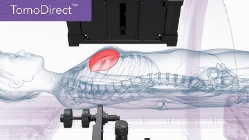 Accuray Radixact Video
