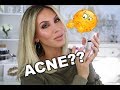 3 Unknown Acne Products that Clear Your Skin Fast!