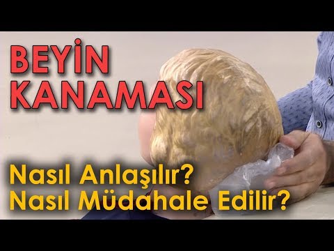 Video: Talamus nədən məsuldur?