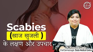 Scabies Treatment, Causes, Symptoms In Hindi | स्केबीज़ का इलाज, कारण, लक्षण | Dadu Medical Centre