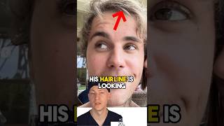 Justin Bieber’s NEW HAIR | Surgeon Analysis