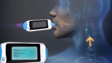 Sensor Technology - Part 1