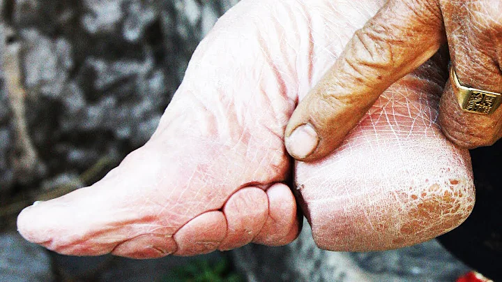 The Horrors Behind Foot Binding - DayDayNews