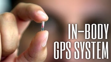 Why an in-body GPS tracker is really useful | ReMix in-body GPS microchip