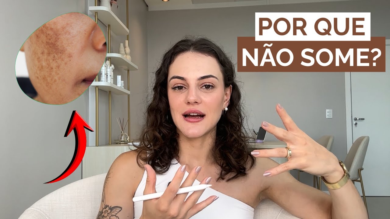 Como Clarear o MELASMA... E por que sempre volta?