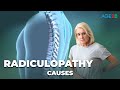 Causes and Treatment Options for Radiculopathy | How To Overcome Radiculopathy
