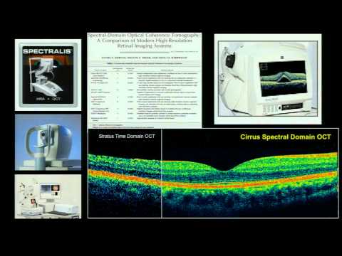 AAO 2013 Shaffer Lecture: Dr. Joel Schuman (UPMC) - Glaucoma Changes: Reality Bites