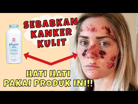 hati-hati!!-5-bahan-kosmetik-berbahaya-penyebab-kanker-/jerawat..