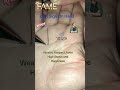 6v triangle yousafpalmist palmistry handreading palmisthandlinepalmist