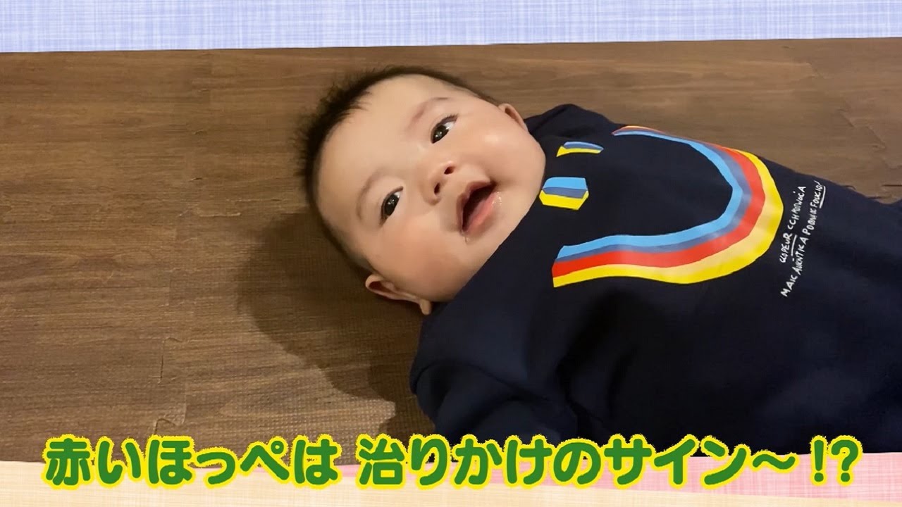 公式 赤いほっぺは 治りかけのサイン 4月3日放送 テレビ西日本 Youtube
