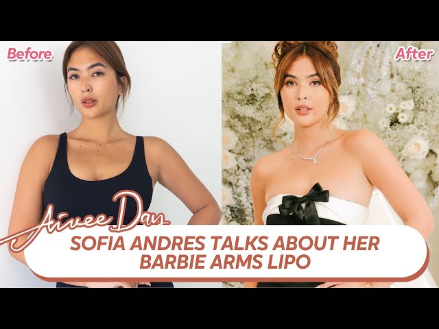 Sofia Andres talks about her Barbie Arms Lipo class=