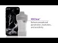 Vscan Air™ raises the bar for handheld ultrasound image quality
